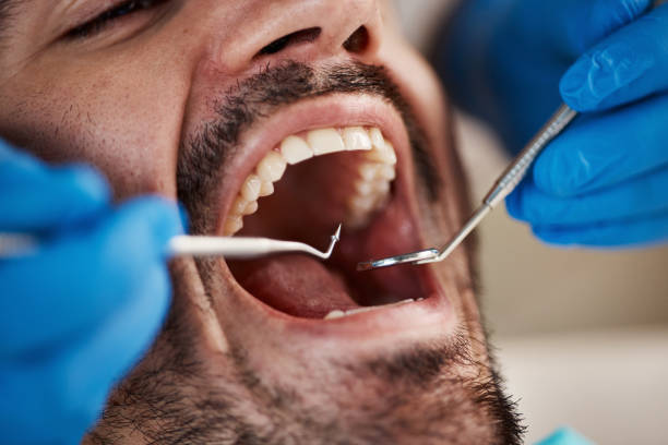 Best Emergency Treatment for Dental Infections or Abscesses in Basking Ridge, NJ