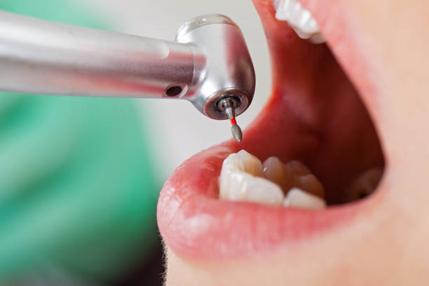 Best Emergency Dental Care for Broken or Chipped Teeth in Basking Ridge, NJ
